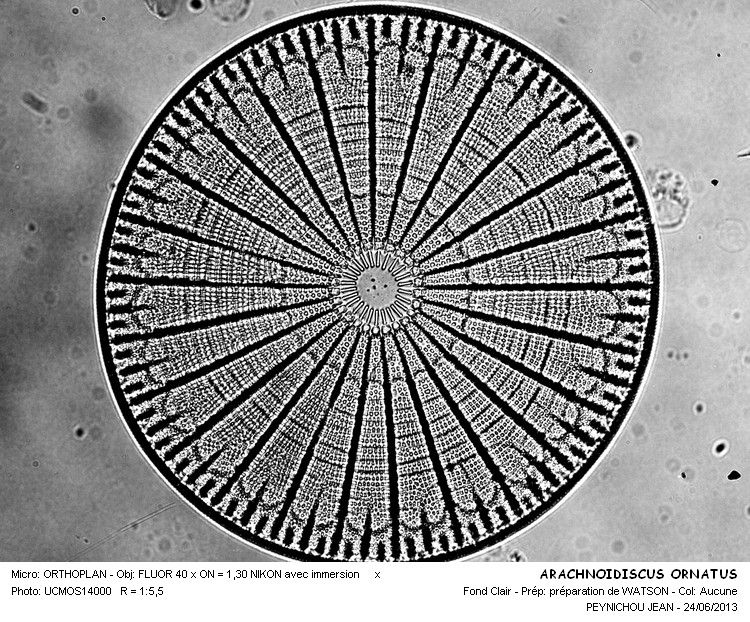 Re: ARACHNOIDISCUS EHRENBERGII BAILEY = ARACHNOIDISCUS ORNATUS EHR #32472