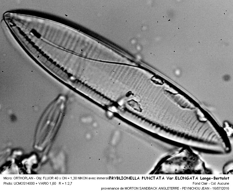 Re: TRYBLIONELLA PUNCTATA Var. ELONGATA Lange-Bertalot #46136