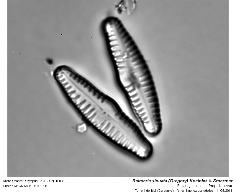 Reimeria sinuata (Gregory) Kociolek & Stoermer #25709