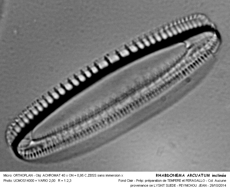 Rhabdonema arctuatum #39532