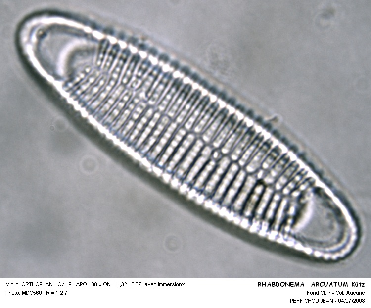 Rhabdonema arctuatum #39496