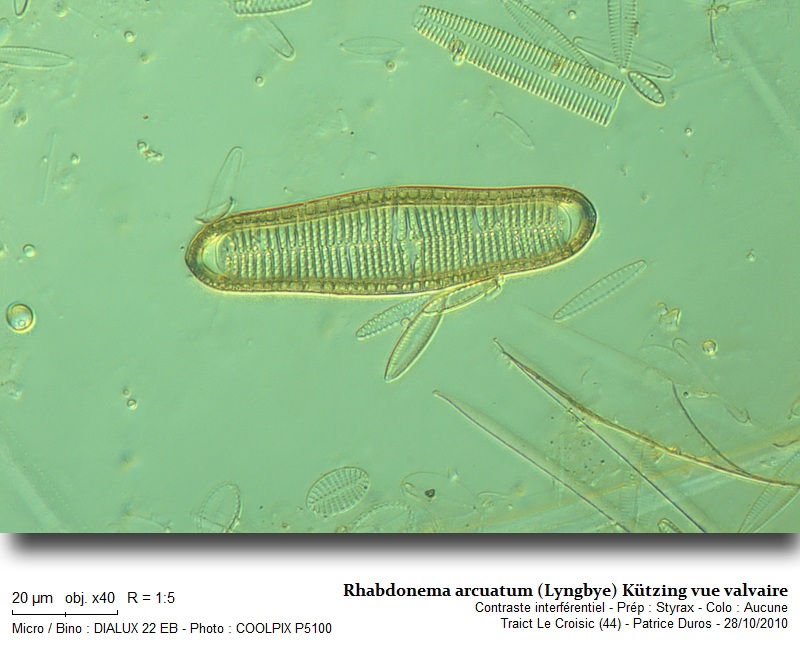 Rhabdonema arcuatum (Lyngbye) Kützing #18802