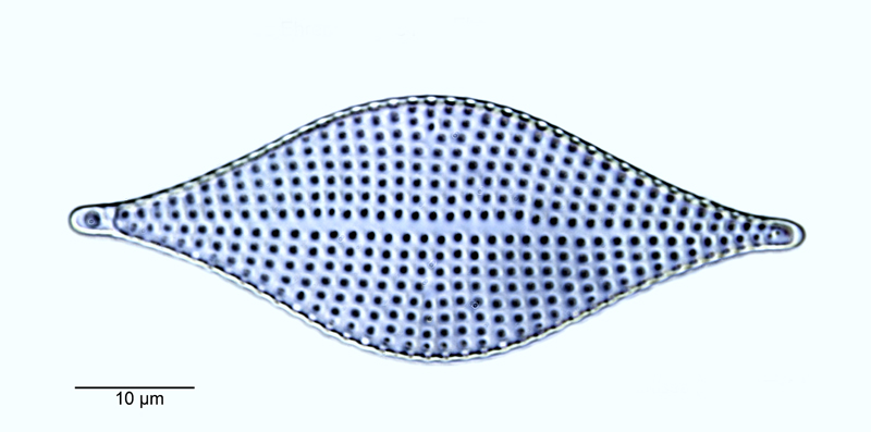 Rhaphoneis amphiceros #55026