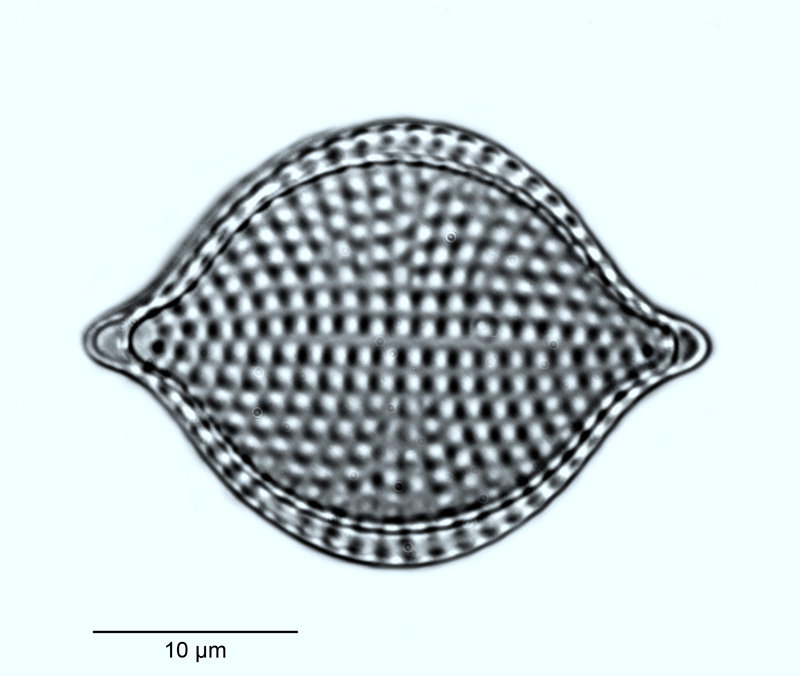 Rhaphoneis amphiceros var. rhombica #55391