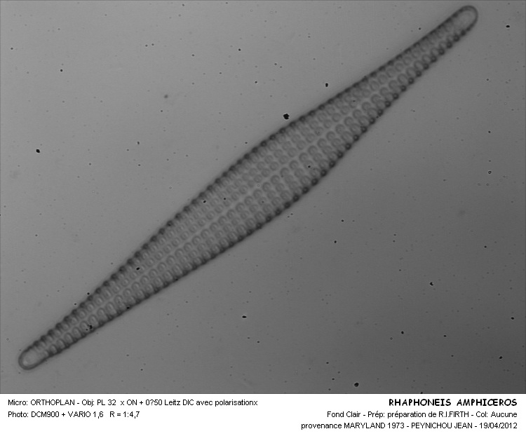 Rhaphoneis amphiceros (Ehrenberg) Ehrenberg #26715
