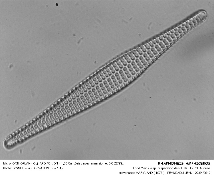 Rhaphoneis amphiceros (Ehrenberg) Ehrenberg #26714