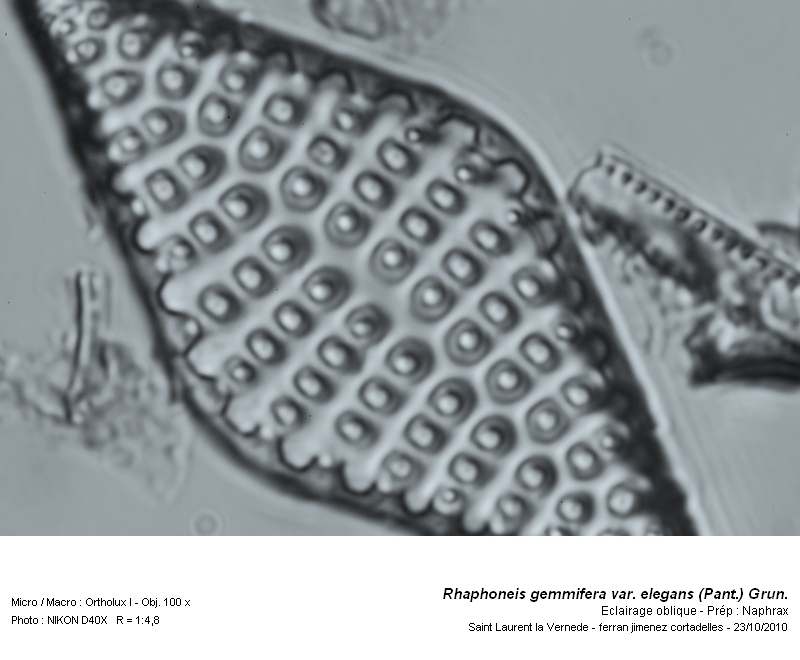 Rhaphoneis gemmifera var. elegans (Pant.) Grun. #18672