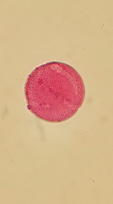 Rheum Rhaponticum #31113