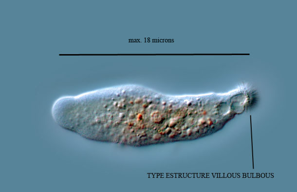 Rhizamoeba flabellata #1216
