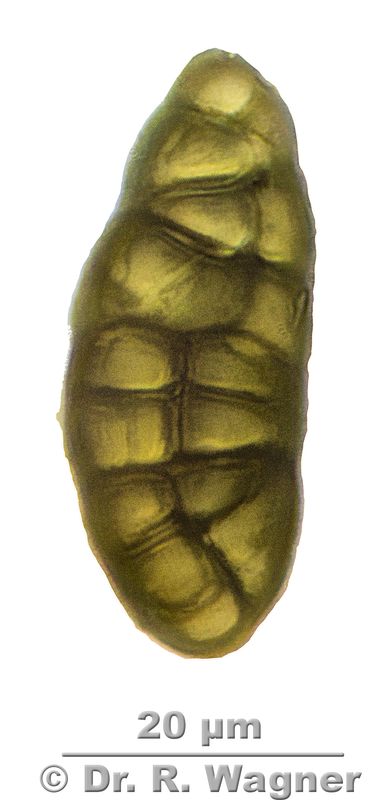 Rhizocarpon lecanorinum #53573