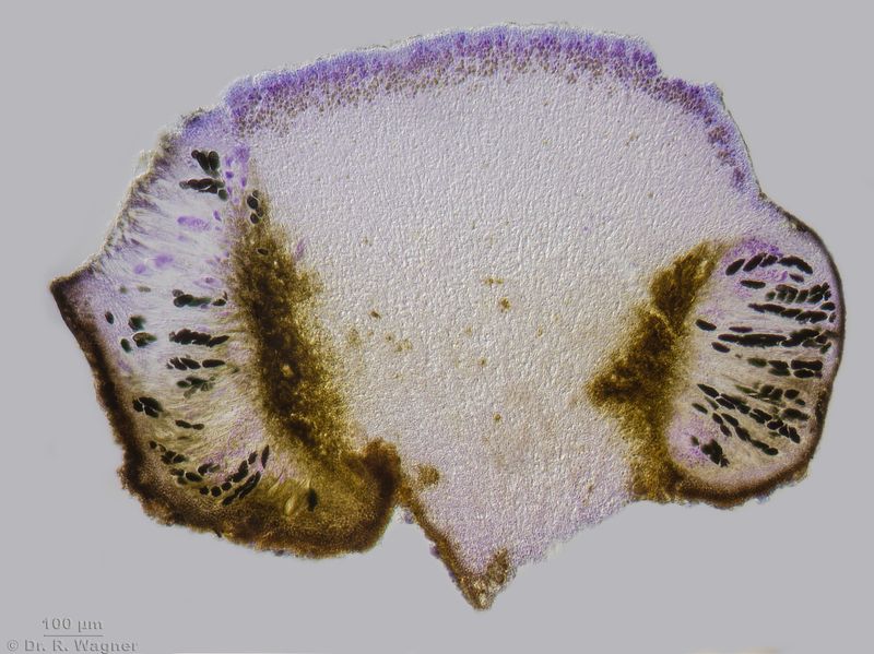Rhizocarpon lecanorinum #53571