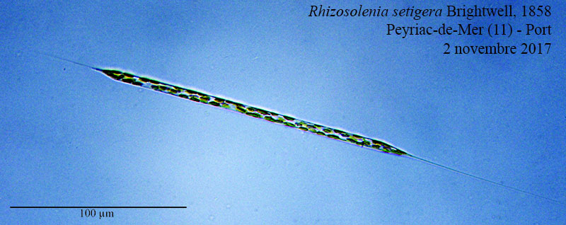 Rhizosolenia setigera #52420