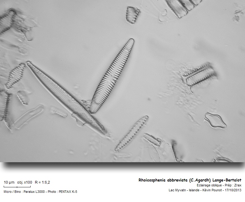 Rhoicosphenia abbreviata (C.Agardh) Lange-Bertalot #34342
