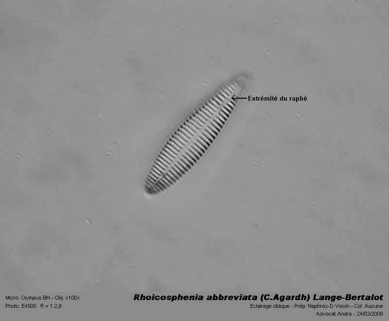 Rhoicosphenia abbreviata (C.Agardh) Lange-Bertalot #3002