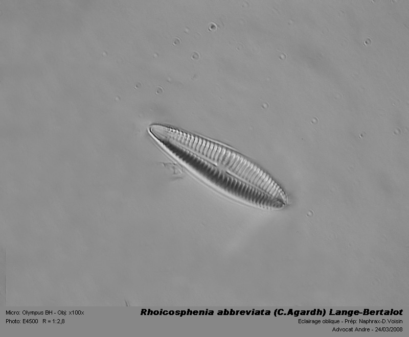 Rhoicosphenia abbreviata (C.Agardh) Lange-Bertalot #3001