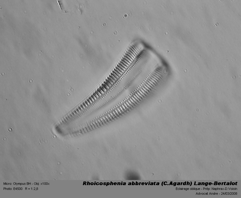 Rhoicosphenia abbreviata (C.Agardh) Lange-Bertalot #3000