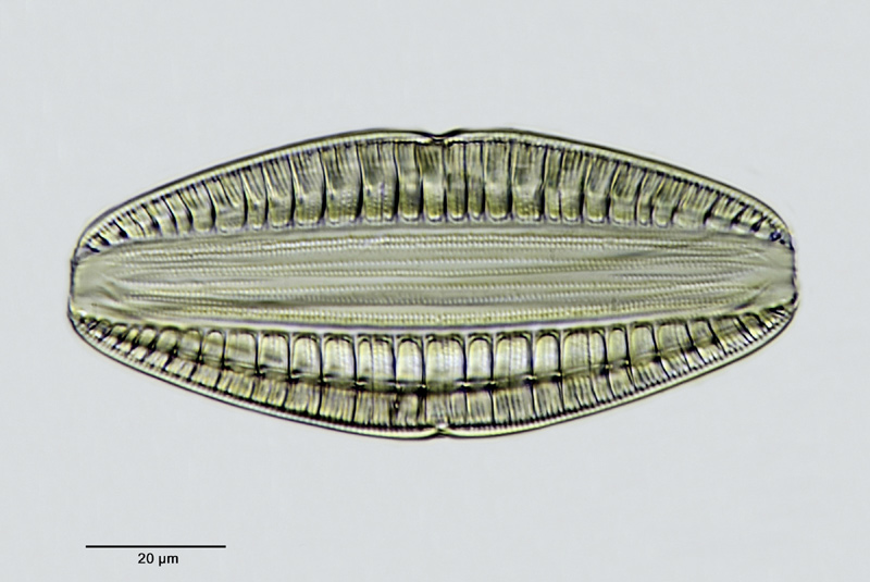 Rhopalodia argentina (Brun in Brun & Tempère) O. Müller 1900 #27173