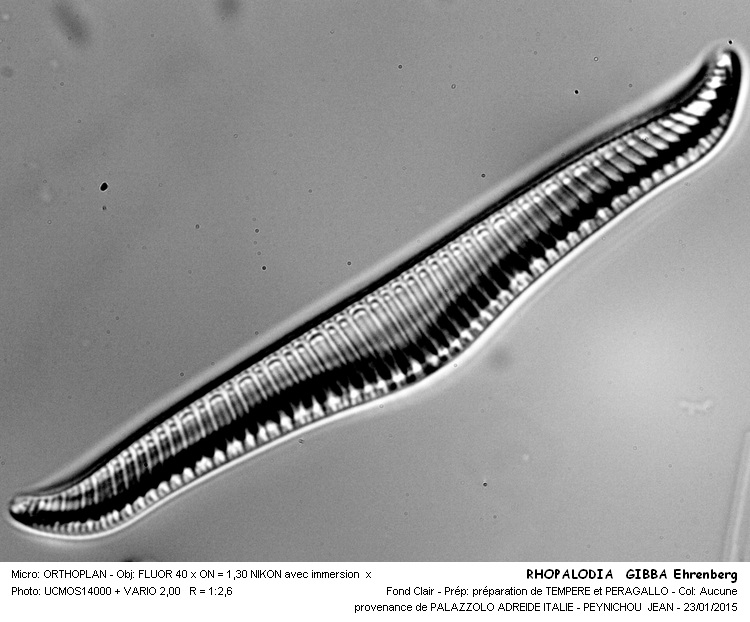 Rhopalodia gibba Ehrenberg #40497