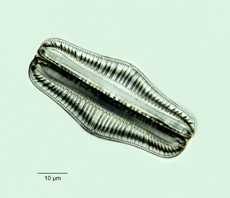 Rhopalodia gibba var. ventricosa (Kütz.) Peragallo #18646