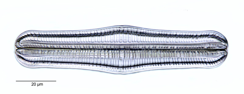 Rhopalodia gibba #53117