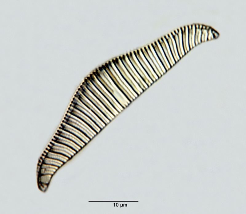 Rhopalodia gibba (Ehrenberg) O. Müller var. gibba #25961