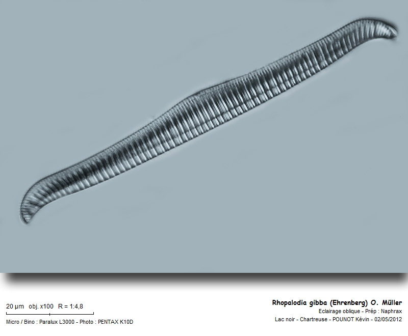 Rhopalodia gibba (Ehrenberg) O. Müller(1895) #26813