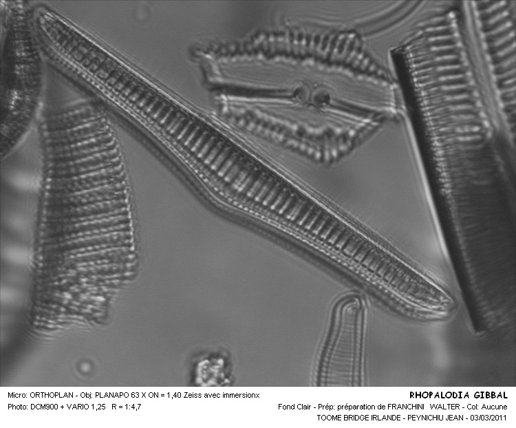 Rhopalodia gibba #37896