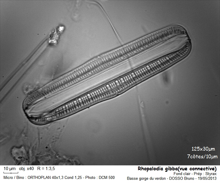 Rhopalodia gibba(Ehr)O. Müller(1895) #31192