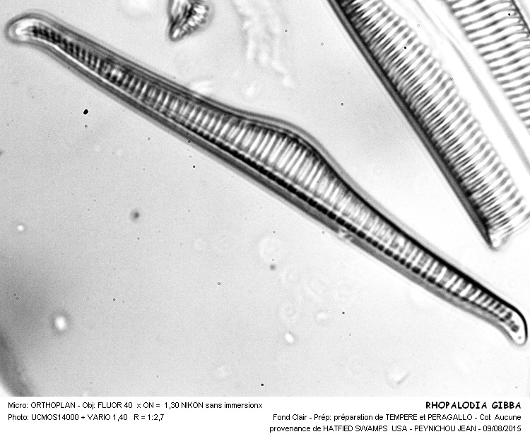 RHOPALODIA GIBBAL #41862