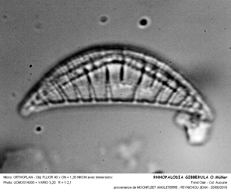RHOPALODIA GIBBERULA O.Müller #45810