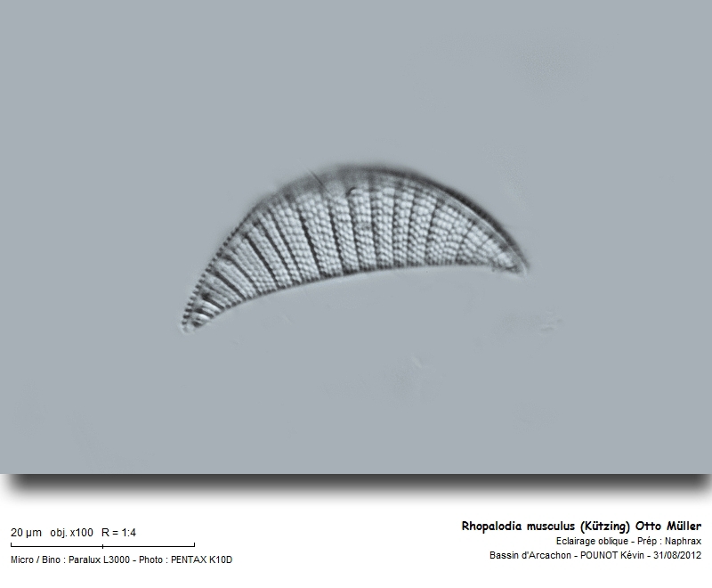 Rhopalodia musculus (Kützing) Otto Müller #28083