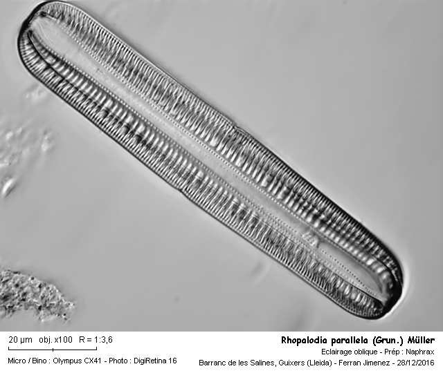 Rhopalodia parallela (Grun.) Muller #49578