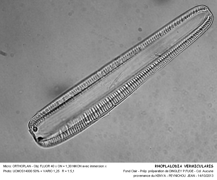 RHOPALODIA VERMICULARIS #34294