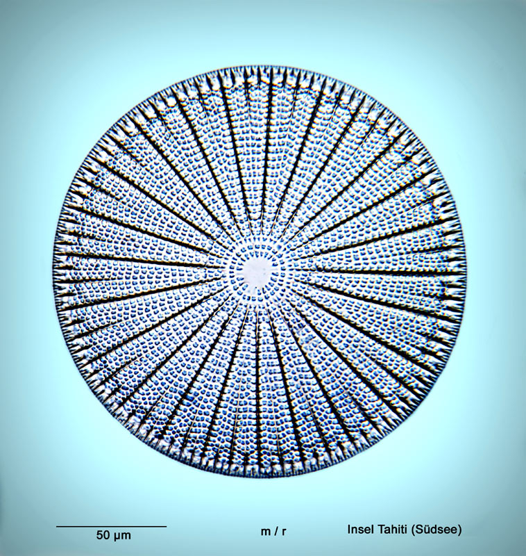 Rosette de diatomees de Albert Elger #35109