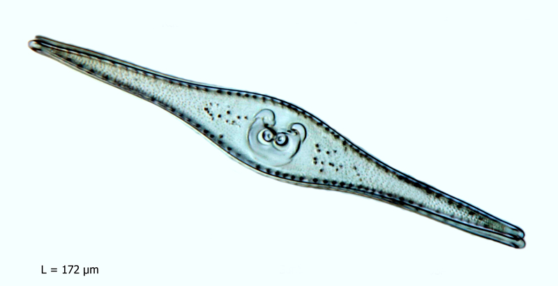 Rutilaria epsilon var. longicornis #66270