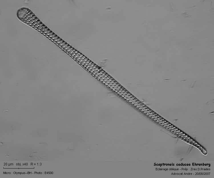 Sceptroneis caducea Ehrenberg #60