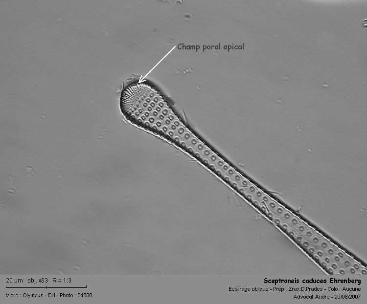 Sceptroneis caducea Ehrenberg #61