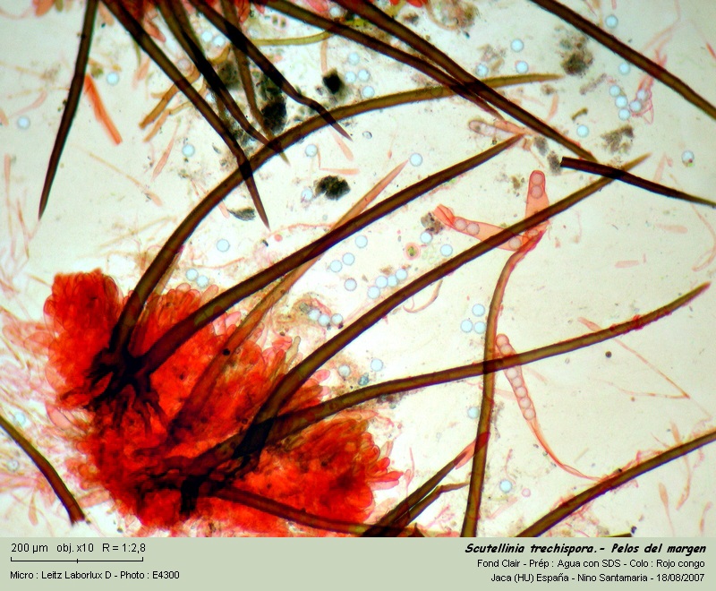 Scutellinia trechispora (Berk. & Broome) Lambotte #1606