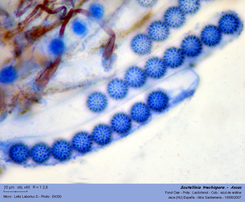 Scutellinia trechispora (Berk. & Broome) Lambotte #1607