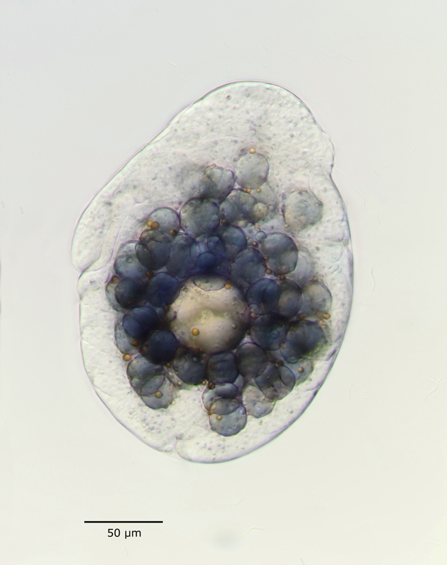 Simocephalus vetulus #17689