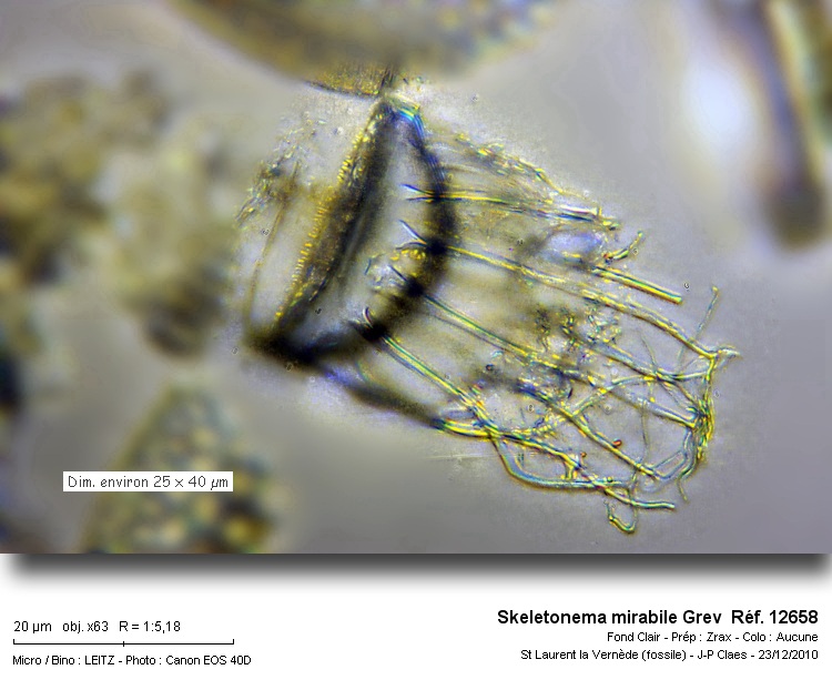 Skeletonema mirabile Grev #24437