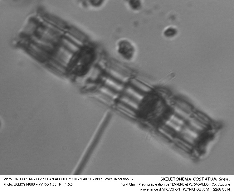 SLELETONEMA COSTATUM Grew. #38278