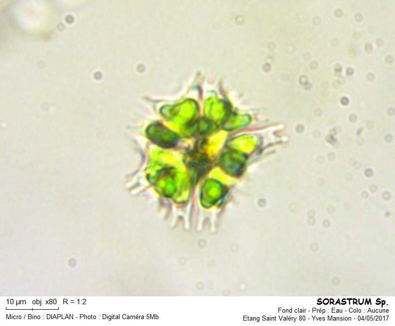 SORASTRUM [Sorastrum spinulosum] #49871