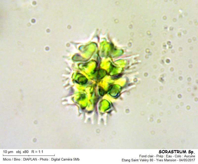 SORASTRUM [Sorastrum spinulosum] #49872