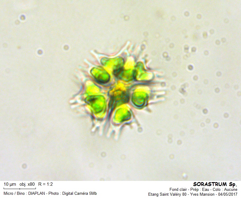 SORASTRUM [Sorastrum spinulosum] #49870