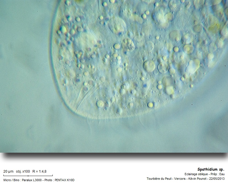 Spathidium sp. #31322