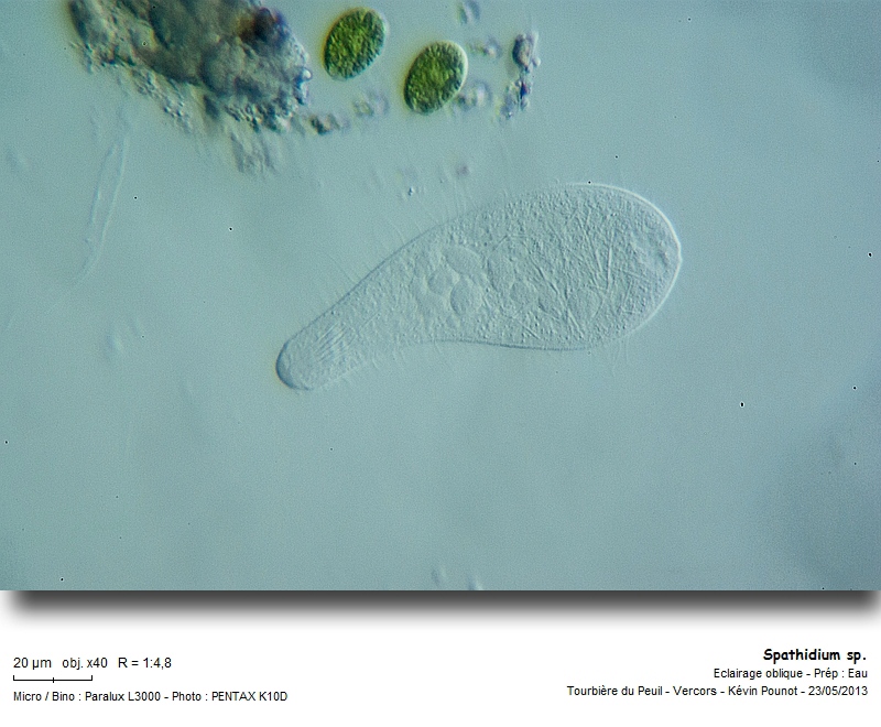 Spathidium sp. #31318