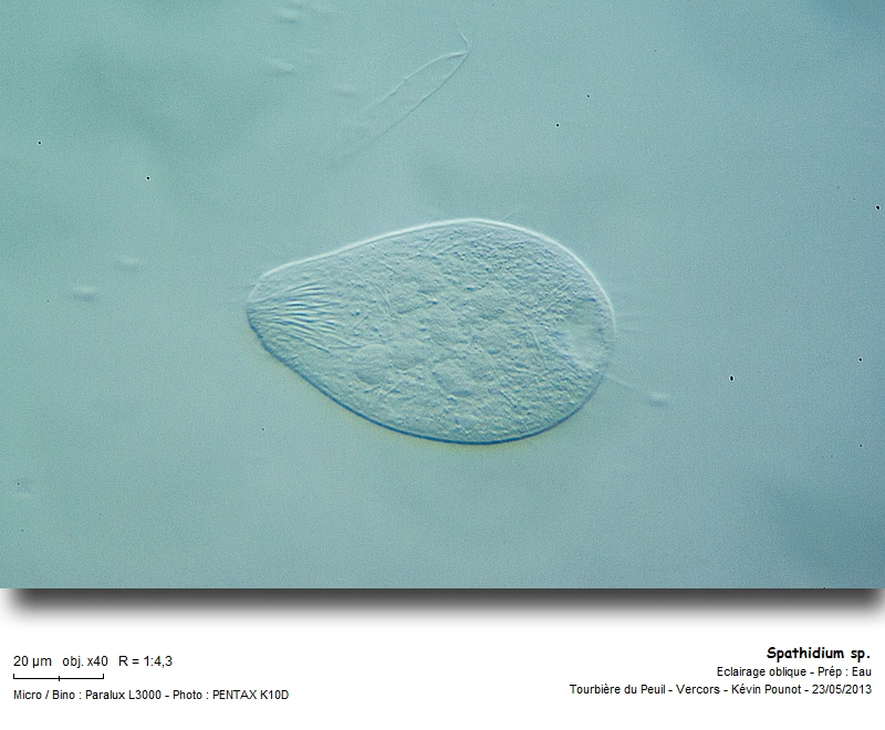 Spathidium sp. #31319
