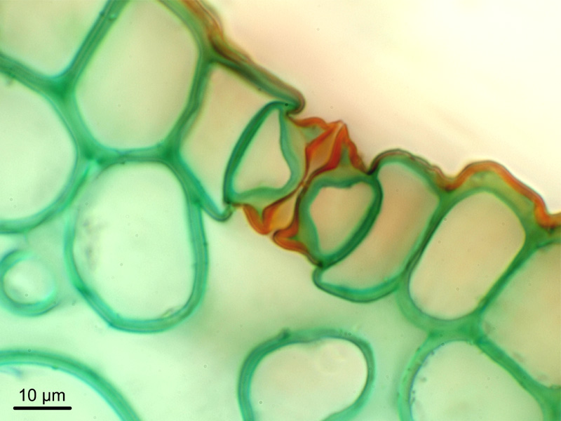 Spathiphyllum sp., histologie #18377