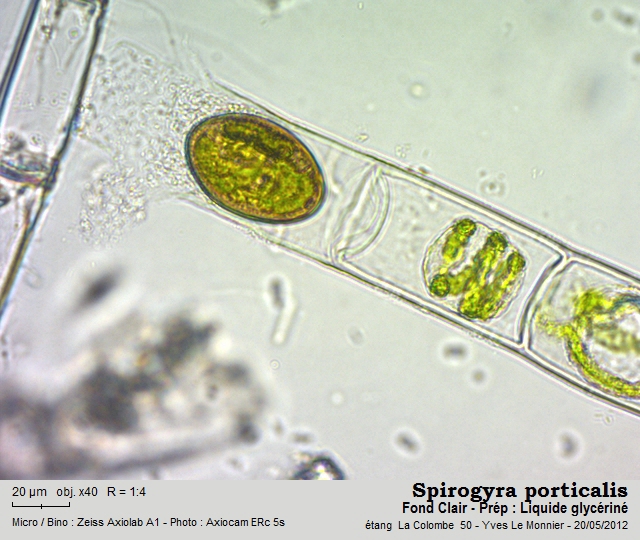 Spirogyra porticalis (O.F. Müller) Cleve 1868 #27122